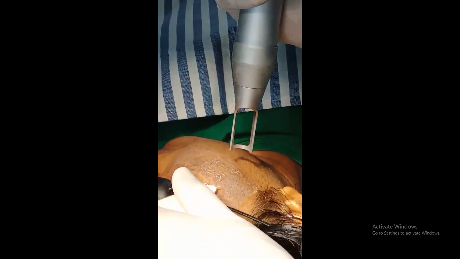 GFC Therapy